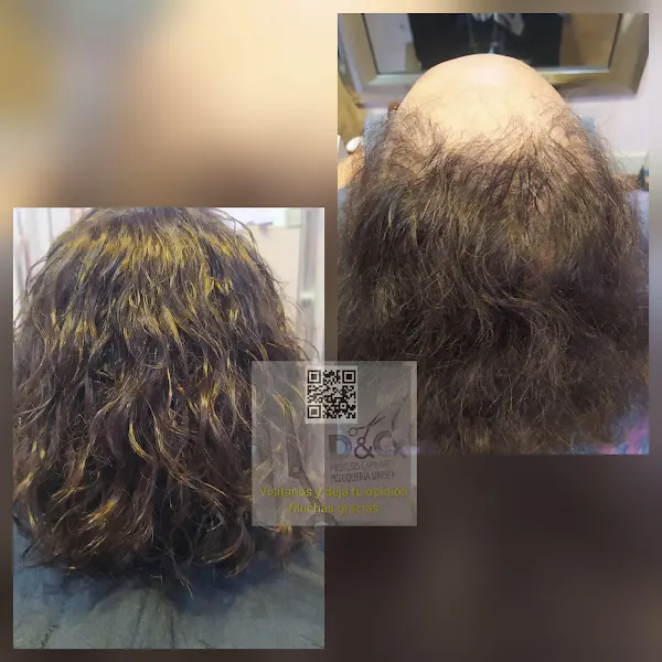 D&C Peluqueria Unisex Y Protesis Capilares - Badajoz