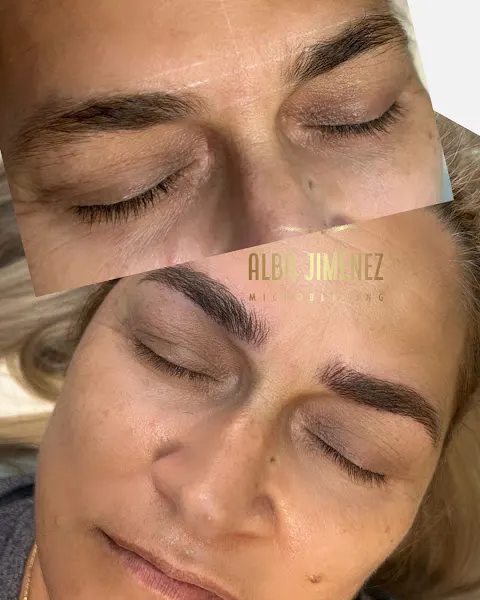 Ángela Laser Beauty