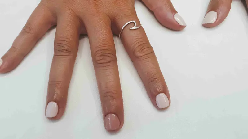 Estética Avanzada Elisa | Astillero
