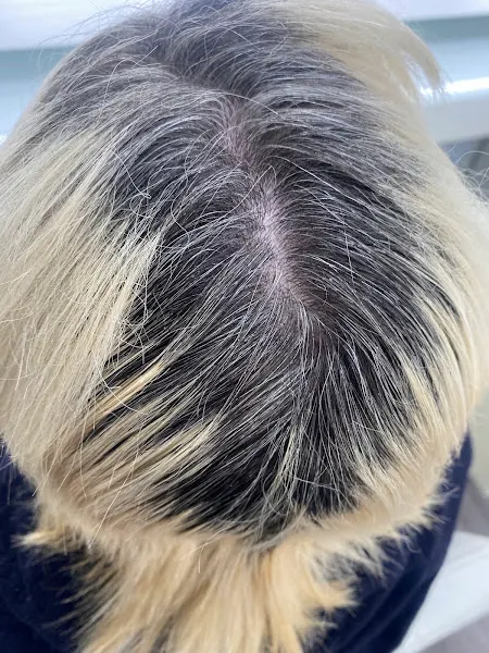 Hairkrone Pozuelo